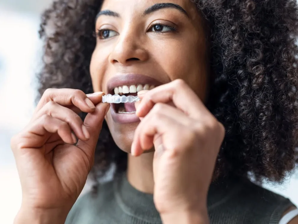 clear-aligners-morningside-dental-care
